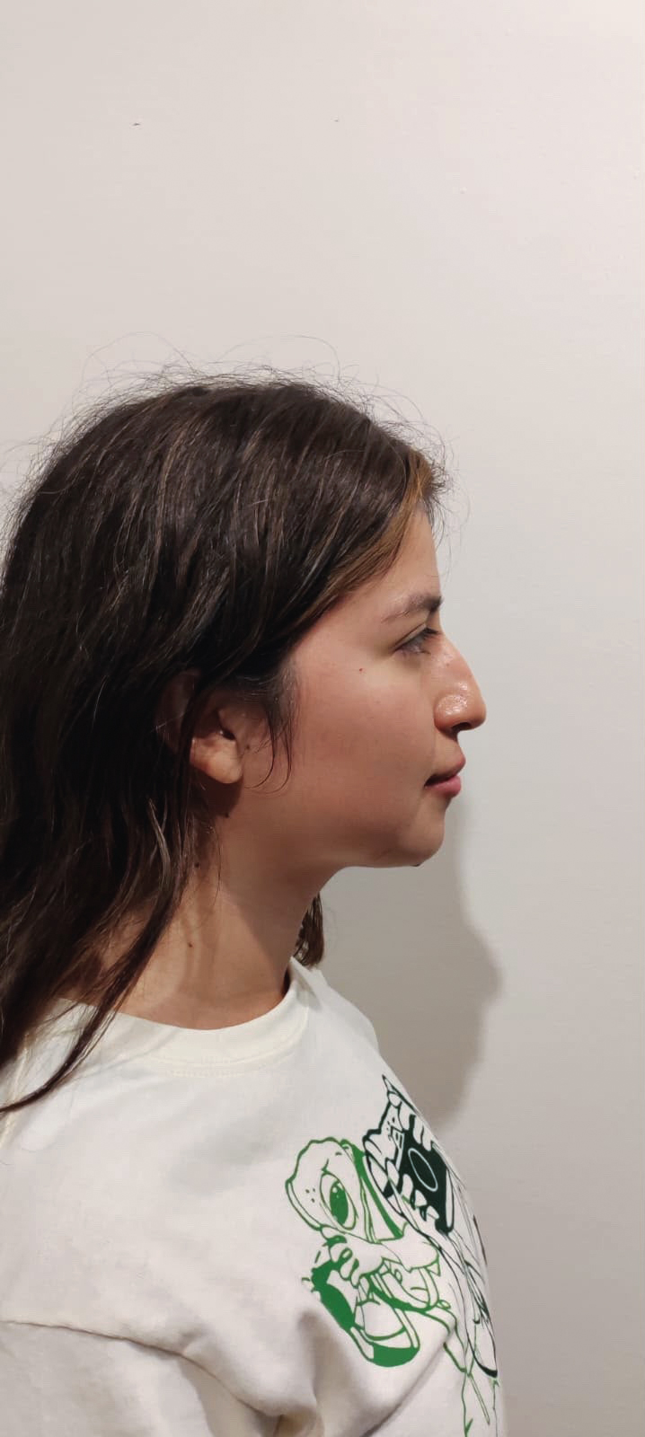 Después, perfil